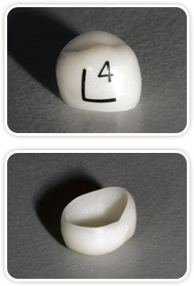 We are the manufacturer of KidCadCrowns® 2.0. We are the manufacturer of KidCadCrowns® 2.0.